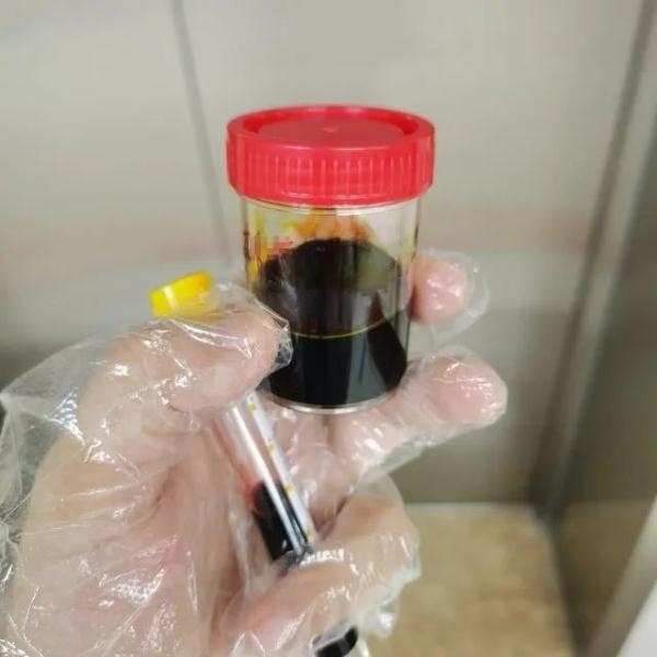 急性肝衰竭！兩兄弟誤吃這種菌 專家提醒